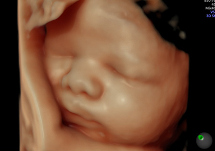 4D超音波外来でお腹の赤ちゃんのかわいい姿をご覧いただけます01